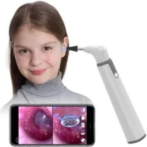 Portable SA39W 3.9mm Ear cleaner wifi digital otoscope